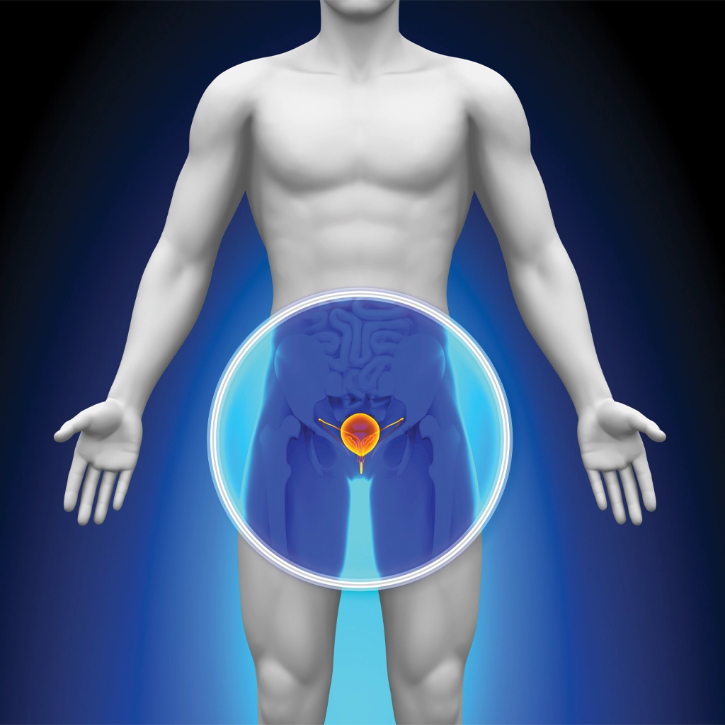 Enlarged Prostate