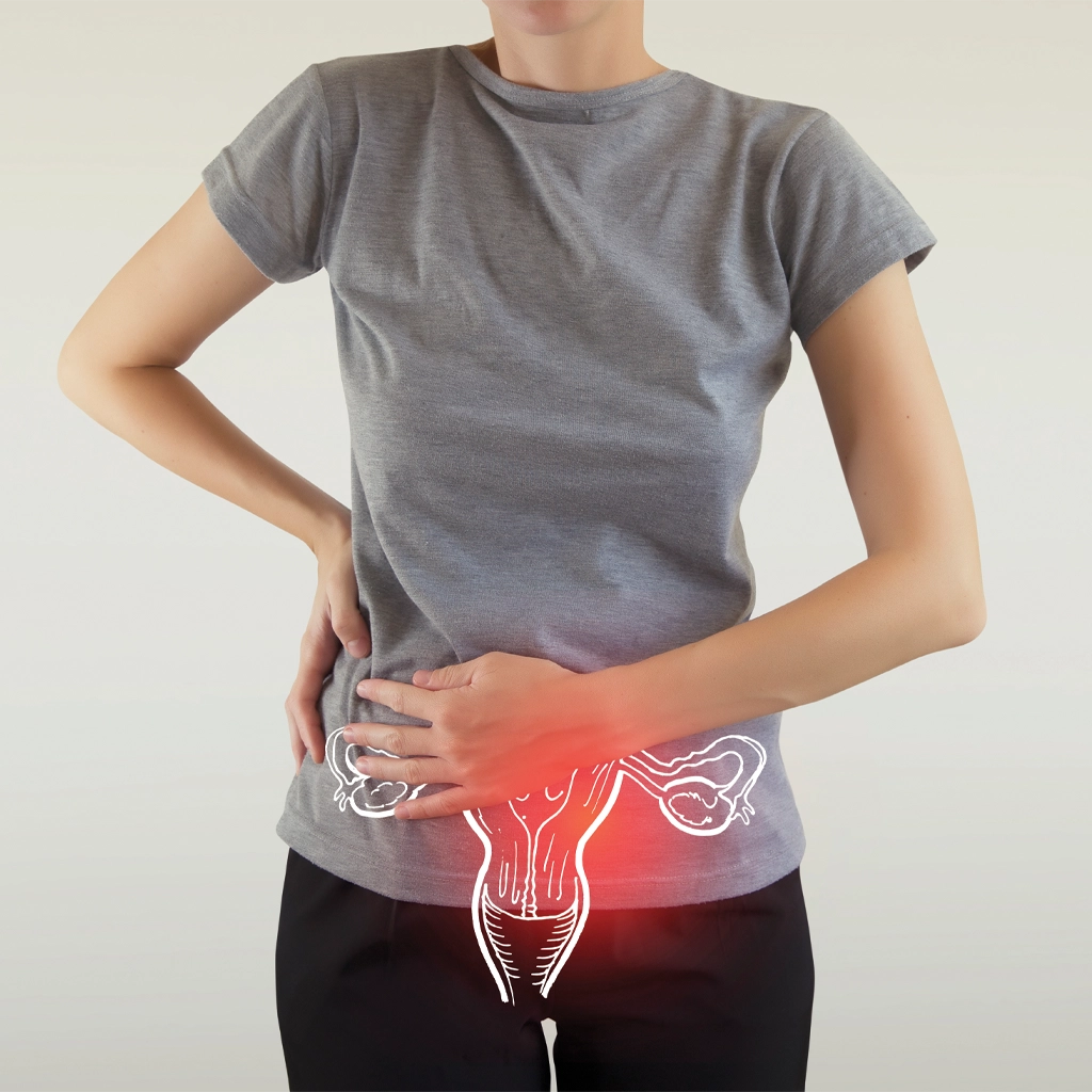 Uterine Fibroids