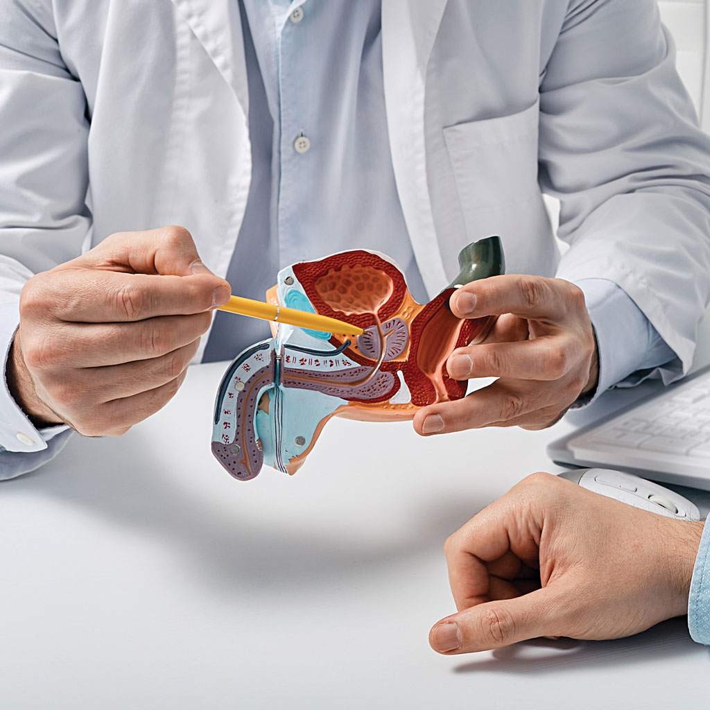 Enlarged Prostate Doctor Showing Model